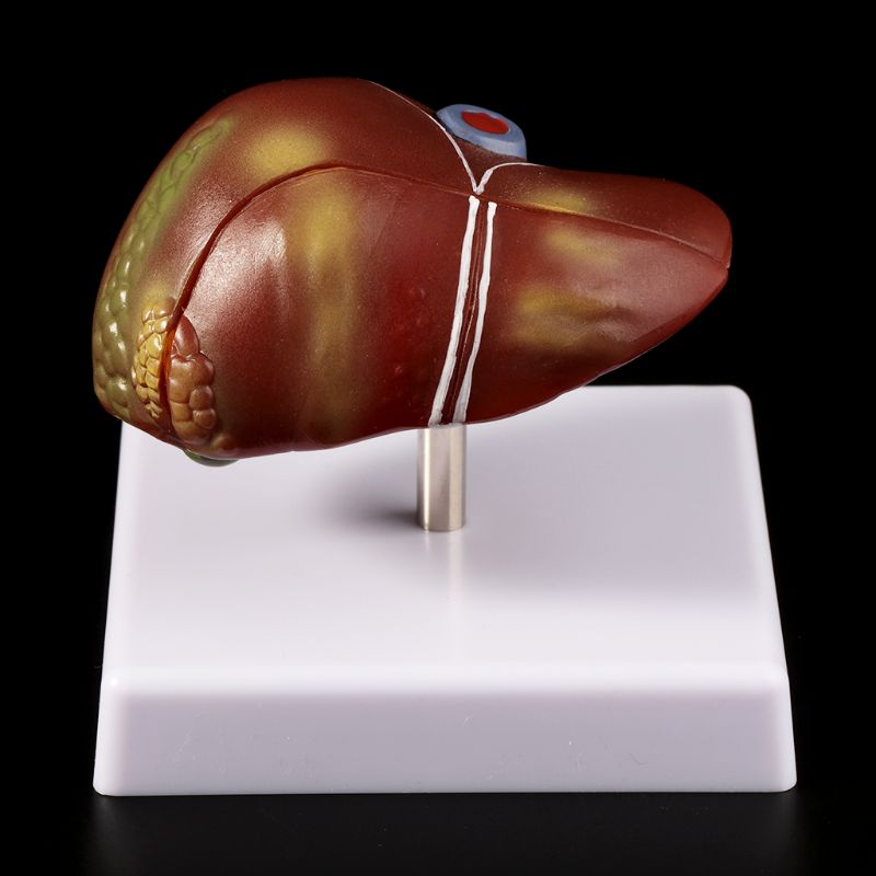 Modelo anatómico patológico hu - Medical Lab Assistant reseña y precio