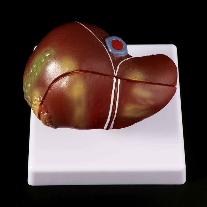 Modelo anatómico patológico hu - Medical Lab Assistant reseña y precio